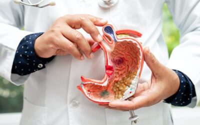 Cure Gallstones problem II